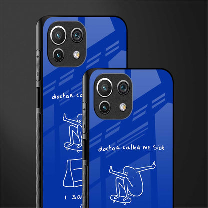 sick skateboarder blue doodle glass case for mi 11 lite image-2