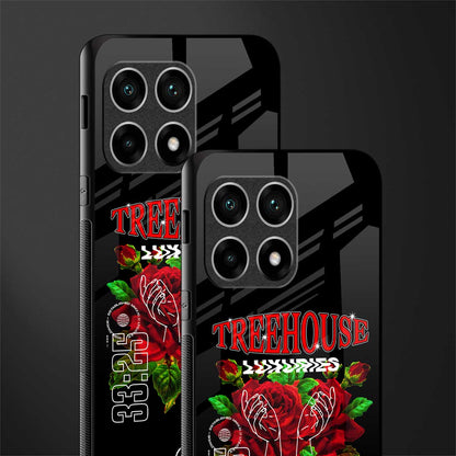 treehouse glass case for oneplus 10 pro 5g image-2