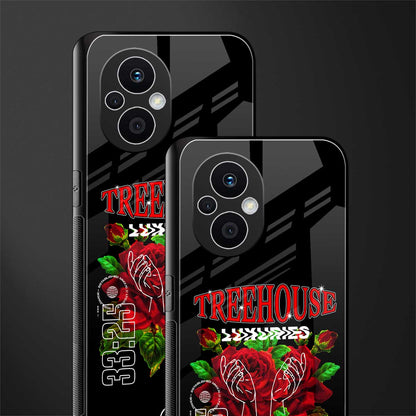 treehouse back phone cover | glass case for oppo f21 pro 5g